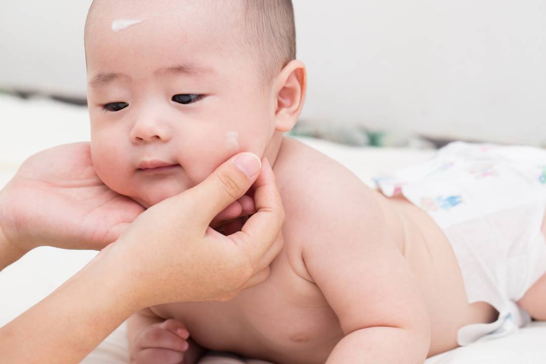 Perawatan Kulit Bayi