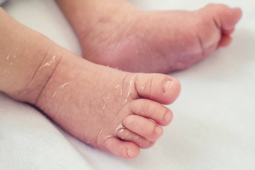 Perawatan Kulit Bayi